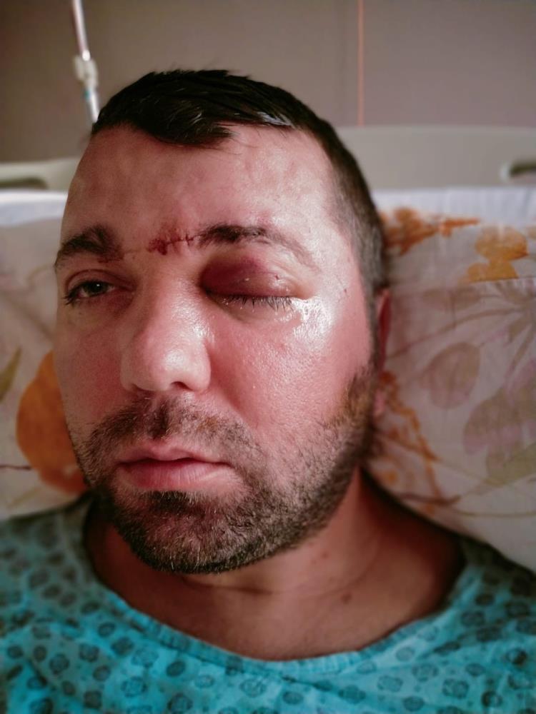 İnanılmaz olay: ‘İmplant tedavisinde vida beynine saplandı’